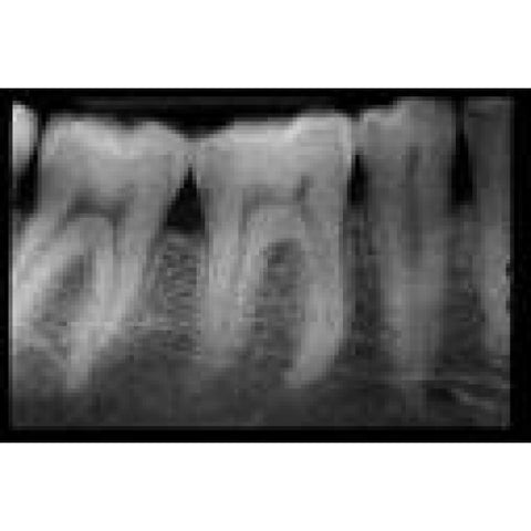 Dental X-Rays Images