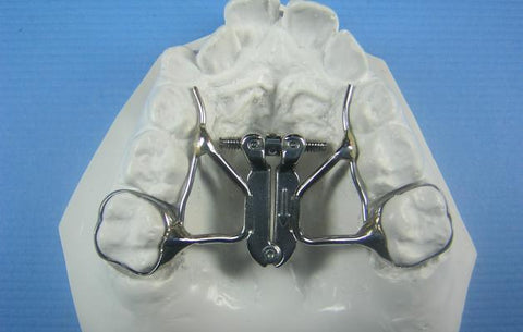 Expansion Appliances Orthodontic Model