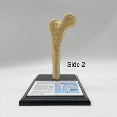 hip osteoporosis Model