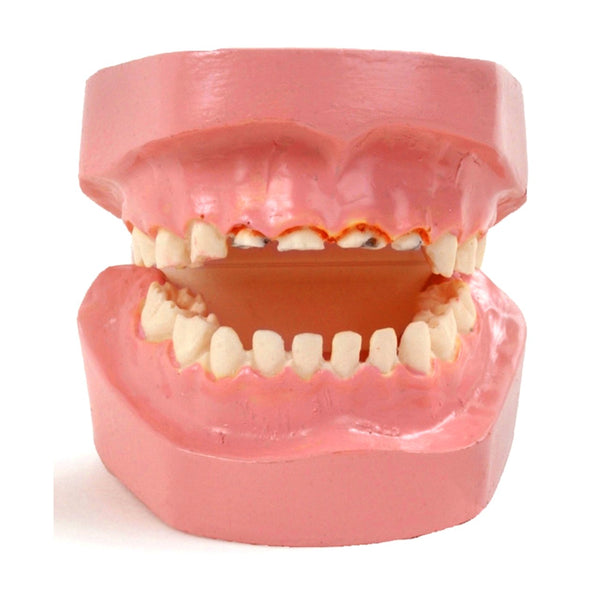 Baby Bottle Tooth Pathology Decay model