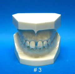 Orthodontic Malocclusion disthema model set