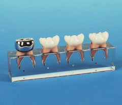 pulpotomy molar model