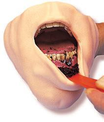 tobacco mouth Gross Of Smokeless Tobacco Mouth 3-D Model Educational Simulator Display