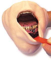 smokeless tobacco teeth mouth model