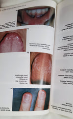 Tongue Fingernail Lunulae Diagnosis Book Dr Chi Method 200 Pages