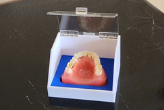 dental cosmetic restoration model