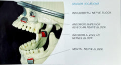 Dental sedation Anesthesia simulator manikin