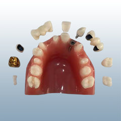 dental patient education model