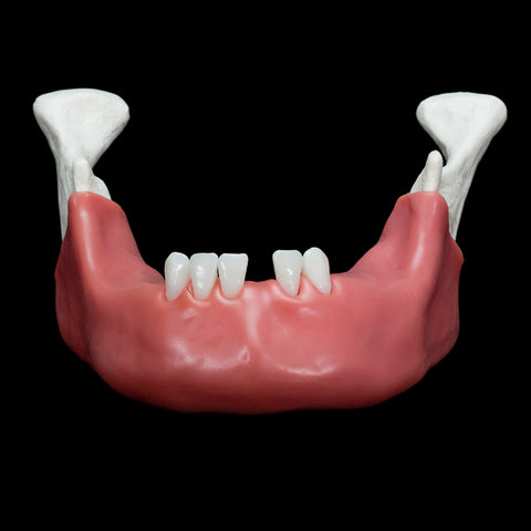 dental surgical drilling model