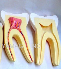 human molar tooth model 
