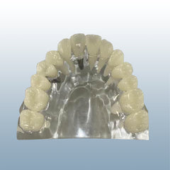 dental implant support bridge model
