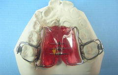 Freedom-Lock  Acrylic Pad orthodontic Retainer 
