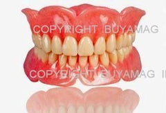 full dentures model