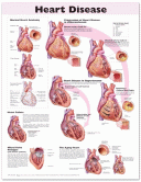 Heart Disease Anatomy Poster