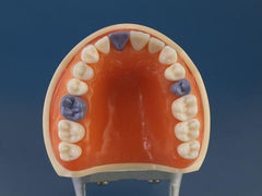 Hygiene Periodontal Assisting Model calibration caries detection