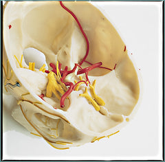Skull Neurovascular Cranial Nerves Arteries Academy Education