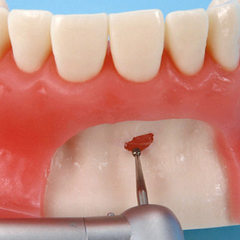 oral surgery model