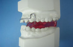 Bionator Close Orthodontic Appliance