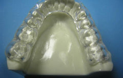 Duraflex Splint Orthodontic Model