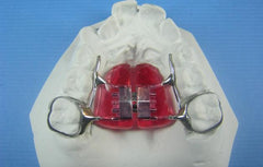 rapid palatal expander orthodontic model