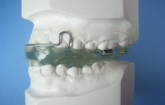 Basic Activator Orthodontic model