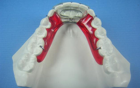 Modified Spring Retainer Orthodontic Model +2