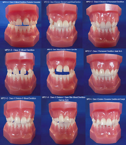 Orthodontic Malocclusion Kit Of 9 models