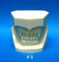 dental malocclusion models 
