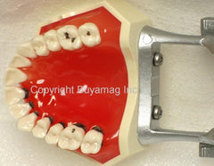 periodontal Model