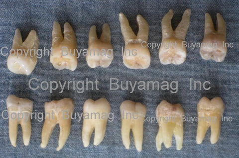 human real teeth for sale molars