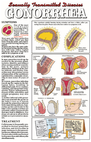 HIV AIDS Gonorrhea STD Disease Poster Chart