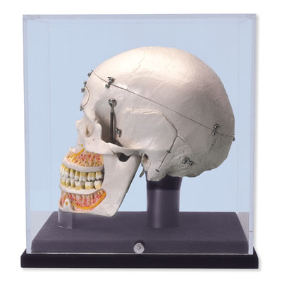 Dental Skull Model With Display Case Deluxe Academy  Dental Skull Academy &
