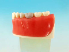 Surgical gum surgical Model