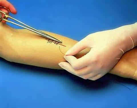 arm skin suturing model simulator