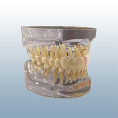 teeth pathology attrition taurodontia abscess model