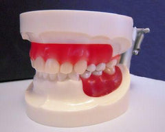 Dental Typodont Model Epoxy Resin Wax