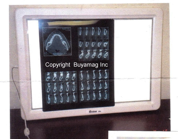 x_ray_viewer_light_box_59477f3