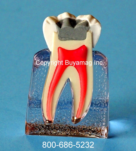 dental models