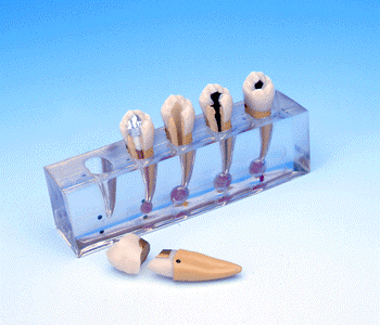 sequence dental model