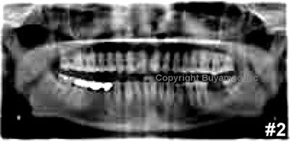 Oral X-Ray Images Education Training