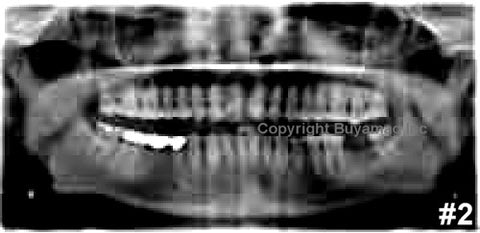 Dental X-Ray Reading Training Images