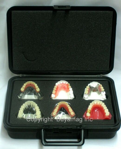 dental models safe storage plastic foam box