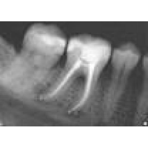 Dental X-Ray Images For Sale