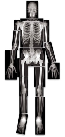 X-Ray Images All Human Parts