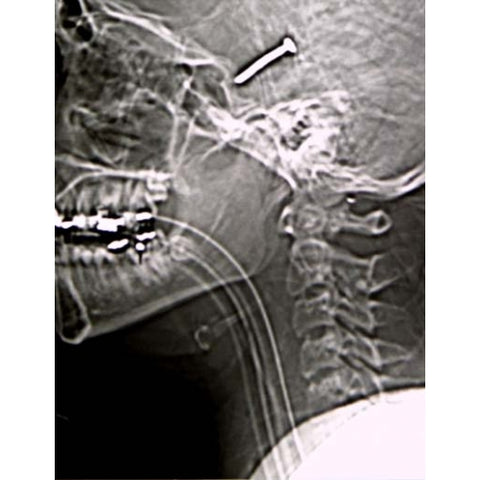 Skull Neck Cervical X-Ray Images 