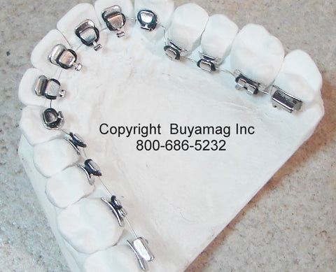 Lingual Brackets Models