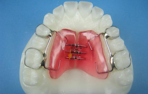 orthodontic models retainers braces appliances