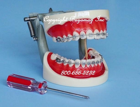 orthodontic model