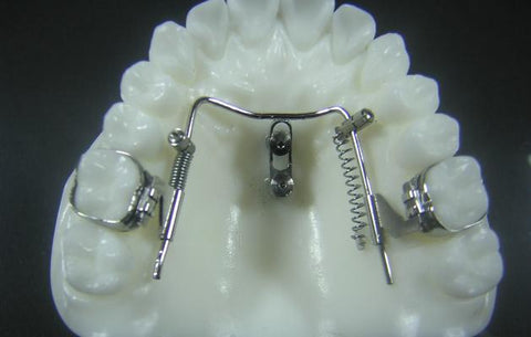 Distalizers Orthodontic Retainers Models