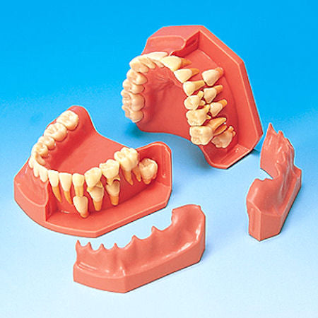 Ortho Eruption Models